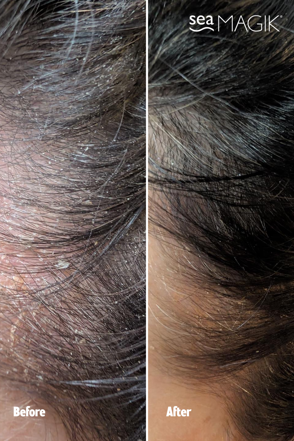 3 SEAWEED HAIR TREATMENT DUO